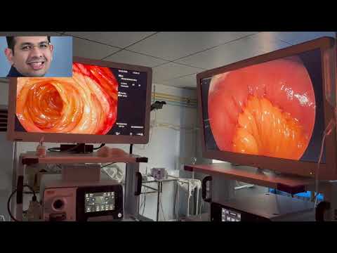 Revision for weight regain - Sleeve to Mini Gastric Bypass | Dr Ameya Thakur